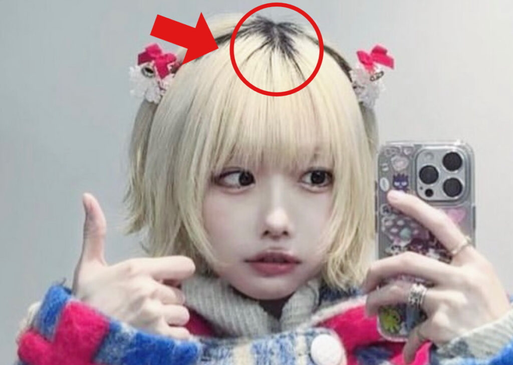 あのちゃんの髪がプリンになっている写真